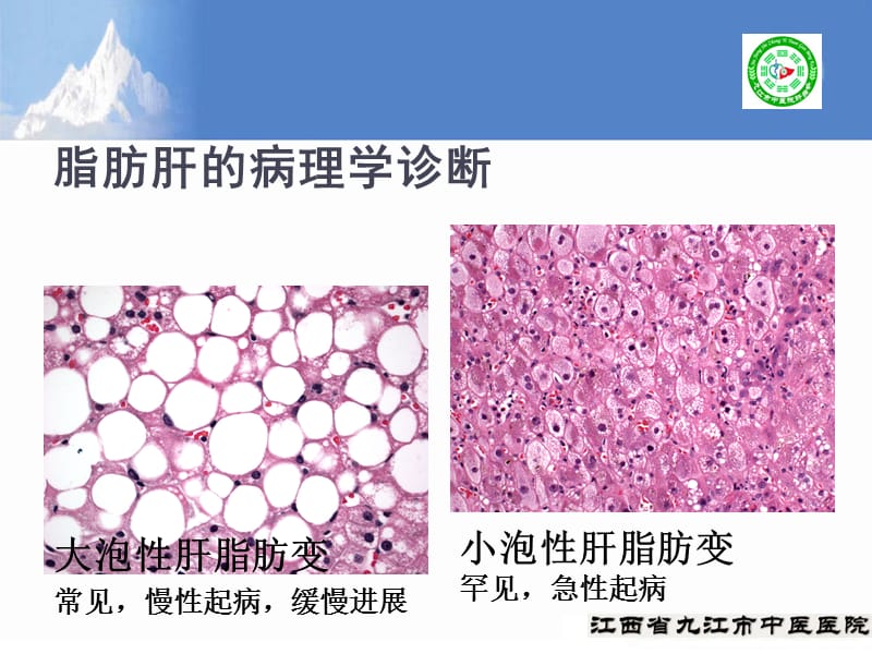 2018非酒精性脂肪性肝病防治指南.ppt_第3页