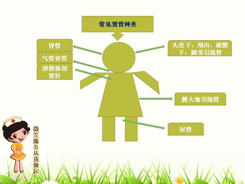 导管的滑脱的危害及预防.ppt_第2页