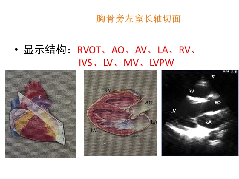 心脏彩超解读完整版.ppt_第3页