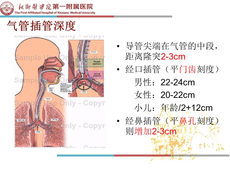 气管插管内吸痰技术.ppt_第3页