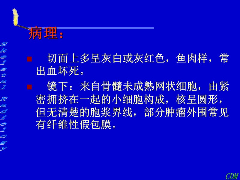 尤文肉瘤影像诊断.ppt_第3页