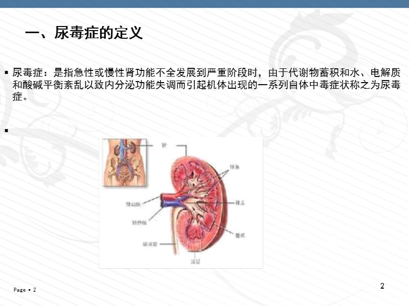 尿毒症病人的护理.ppt_第2页