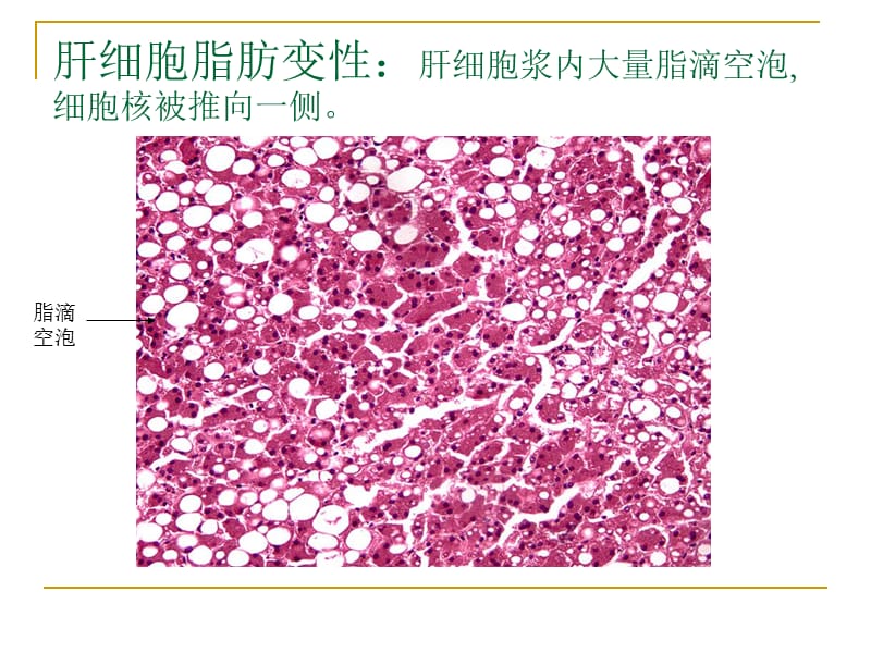 病理学实验切片考试图.ppt_第2页