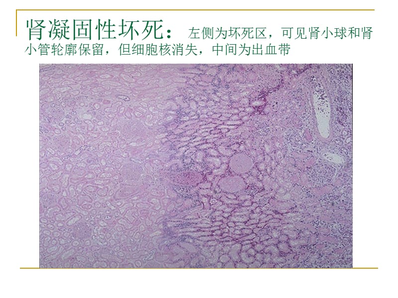 病理学实验切片考试图.ppt_第3页