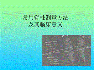 常用脊柱測(cè)量方法及其臨床意義.ppt