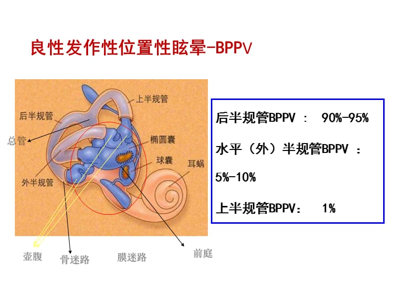 常见4类耳石症的手法复位.ppt_第3页