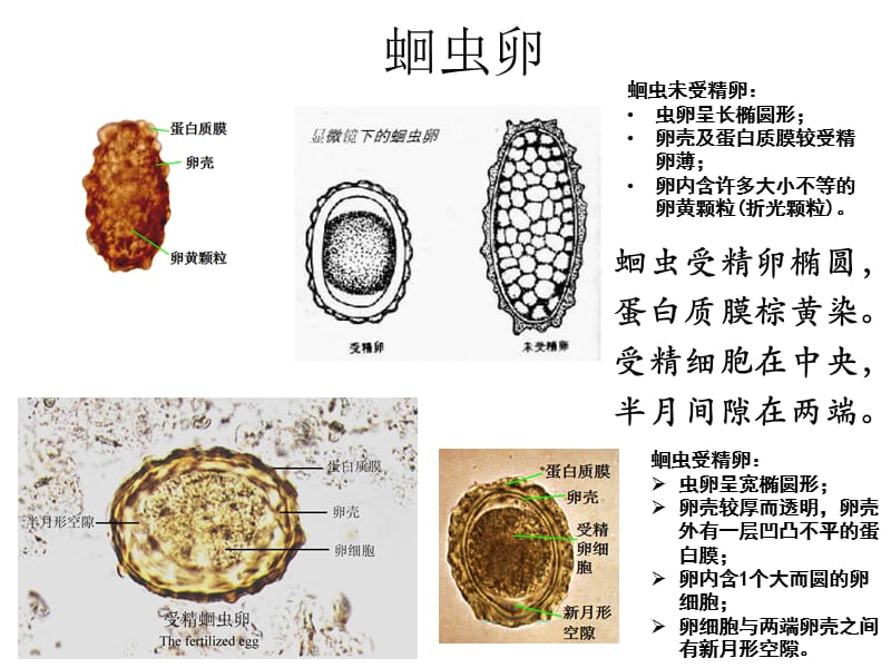 寄生虫学虫卵经典总结及图片课件.ppt_第1页