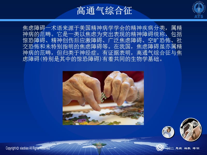 2011过度换气综合症治疗指南.ppt_第3页