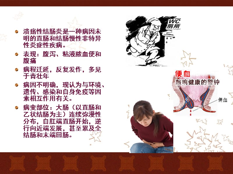 溃疡性结肠炎患者的护理.ppt_第2页