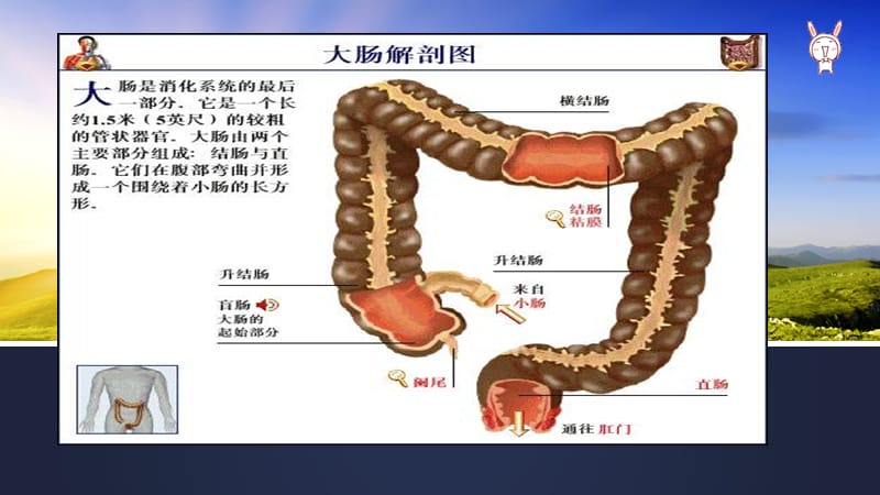 直肠癌伴多发转移的护理查房.ppt_第3页