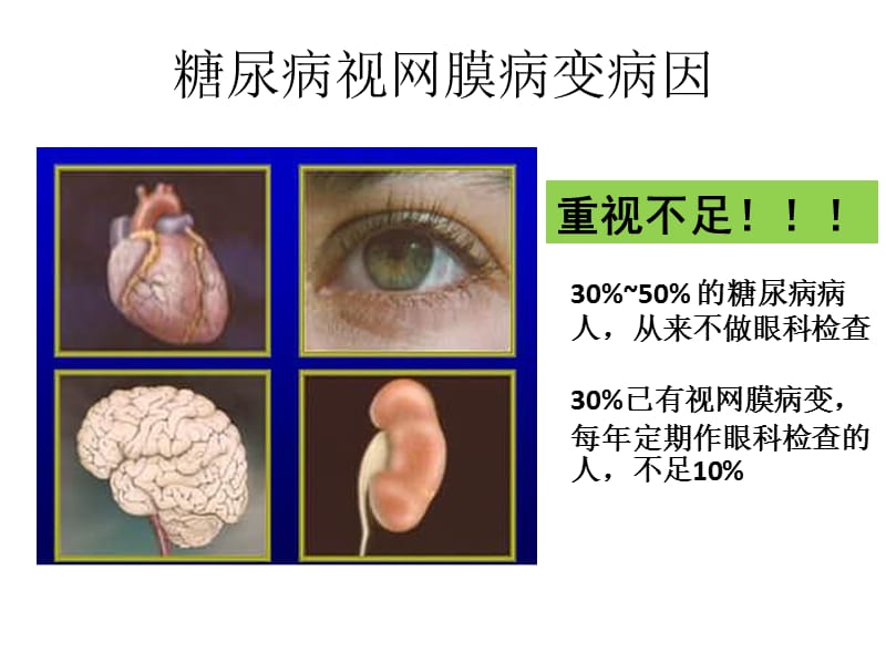 图说糖尿病视网膜病变.ppt_第3页