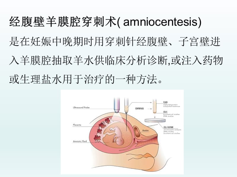 妇产科-常用小手术.ppt_第2页