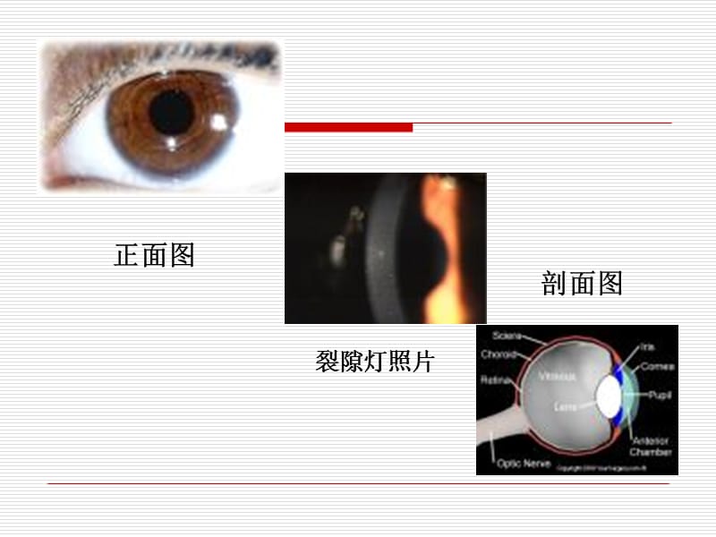 眼视光学与视觉科学眼科学.ppt_第2页