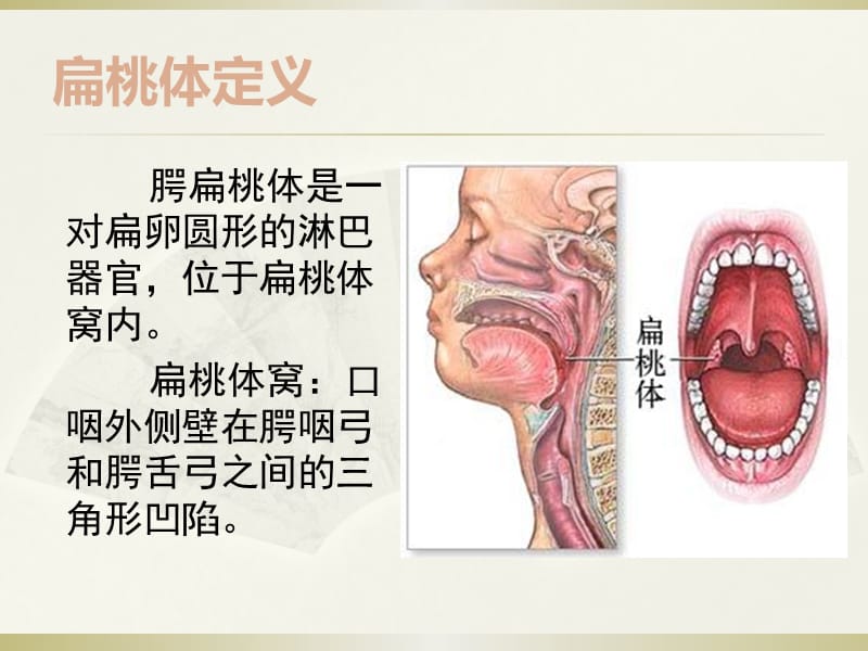 扁桃体及相关内容.ppt_第3页