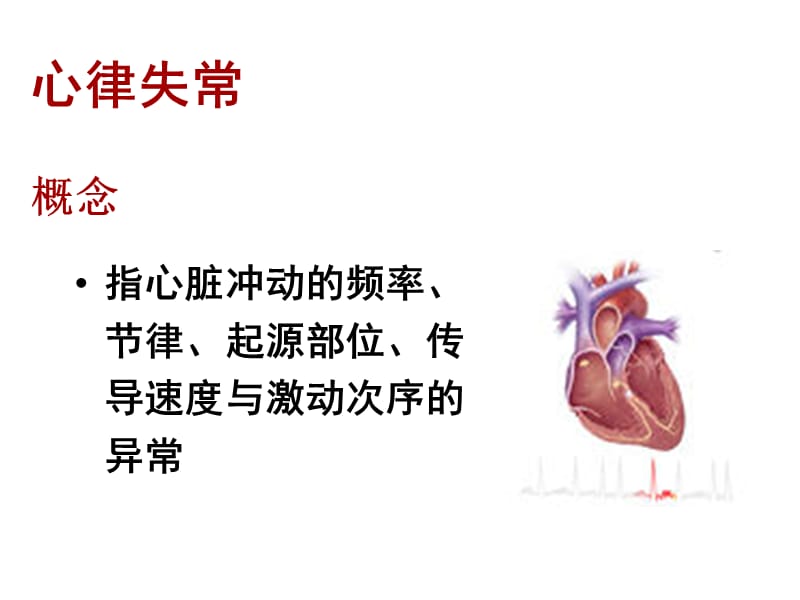 心律失常病人的护理.ppt_第2页