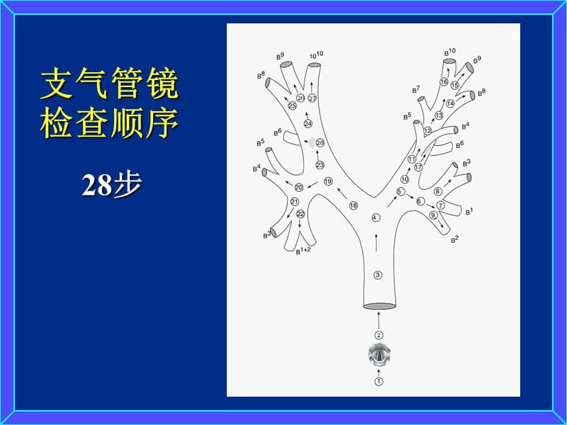 支气管镜检查的顺序及正常支气管的镜下所见.ppt_第2页