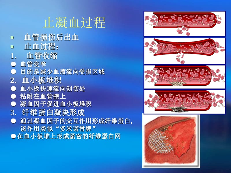 凝血常用指标解读.ppt_第3页