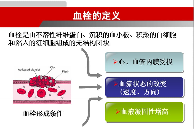 动脉血栓与静脉血栓治疗的比较概要.ppt_第2页