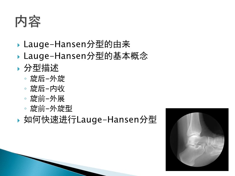 如何正确认识踝关节骨折的Lauge-Hansen分型.ppt_第2页