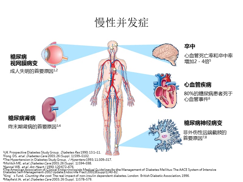 糖尿病急慢性并发症.ppt_第2页