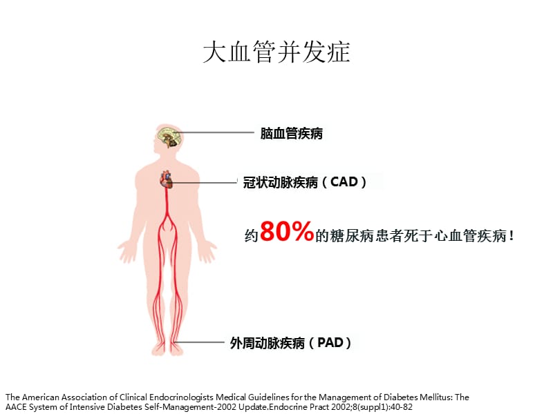 糖尿病急慢性并发症.ppt_第3页