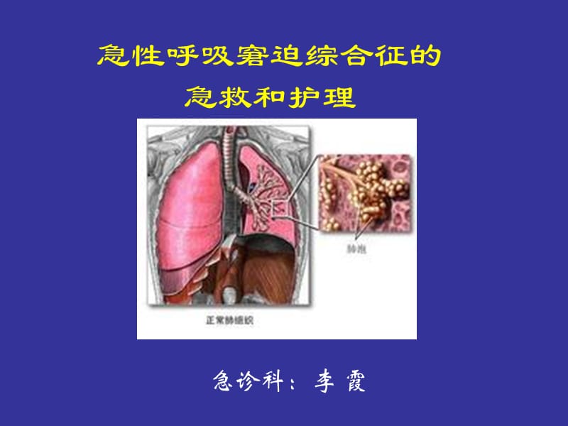 急性呼吸窘迫综合征的急救和护理.ppt_第1页