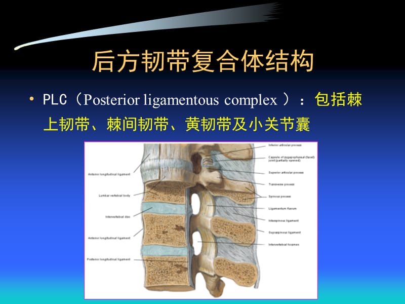 后方韧带复合体损伤的诊断及其临床意义.ppt_第2页