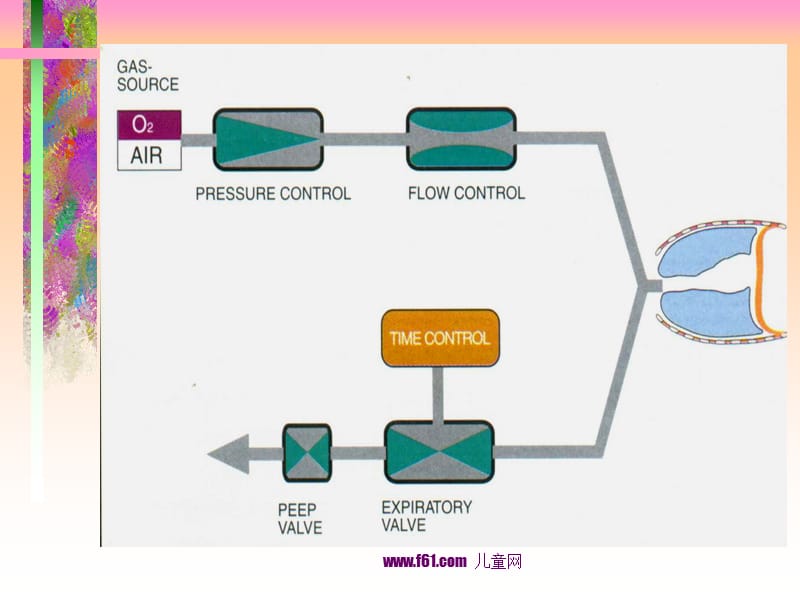 小儿呼吸机参数的调节.ppt_第3页