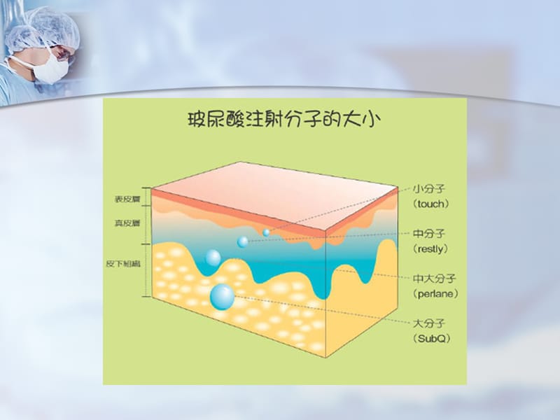 玻尿酸的注射技巧.ppt_第3页