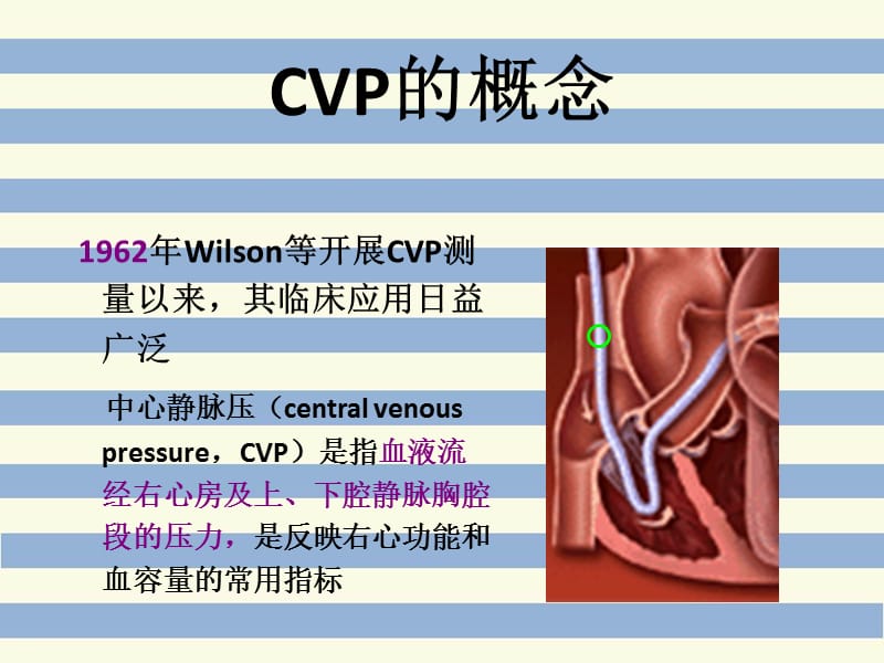 中心静脉压测量CVP.ppt_第3页