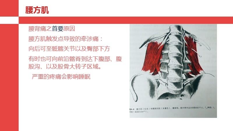 腰部及下肢筋膜触发点.ppt_第2页