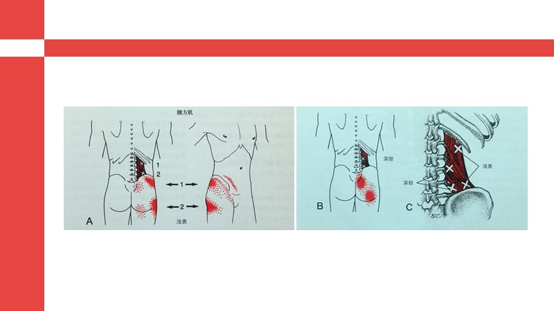 腰部及下肢筋膜触发点.ppt_第3页