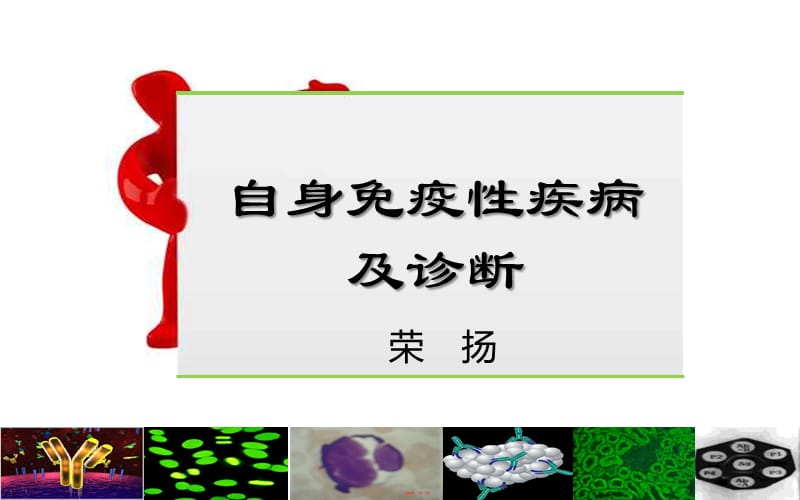 自身免疫性疾病及诊断.ppt_第1页