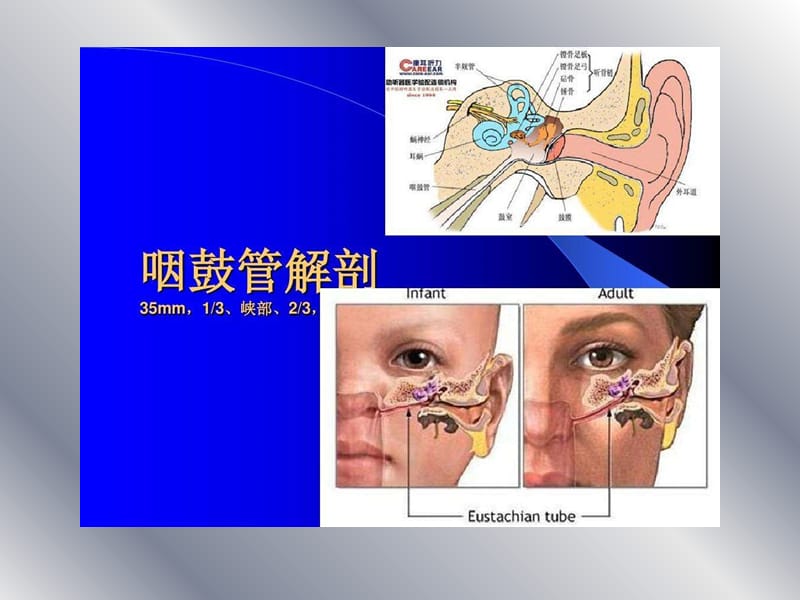 急性化脓性中耳炎课件.ppt_第3页