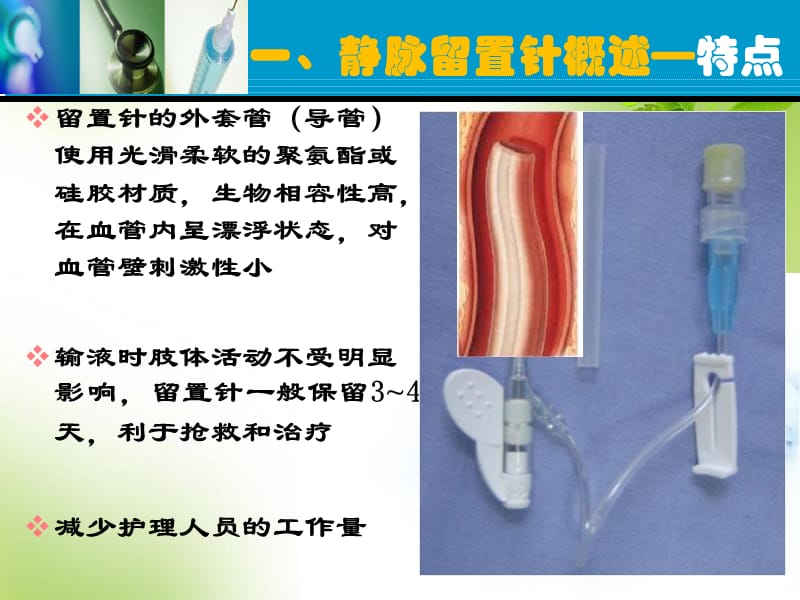 静脉留置针输液法.ppt_第2页