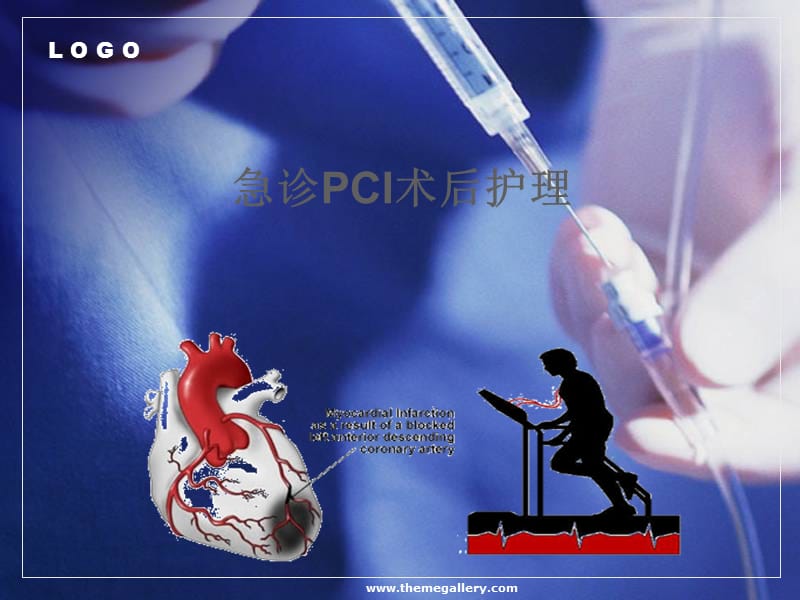 《PCI术后护理》PPT课件.ppt_第1页