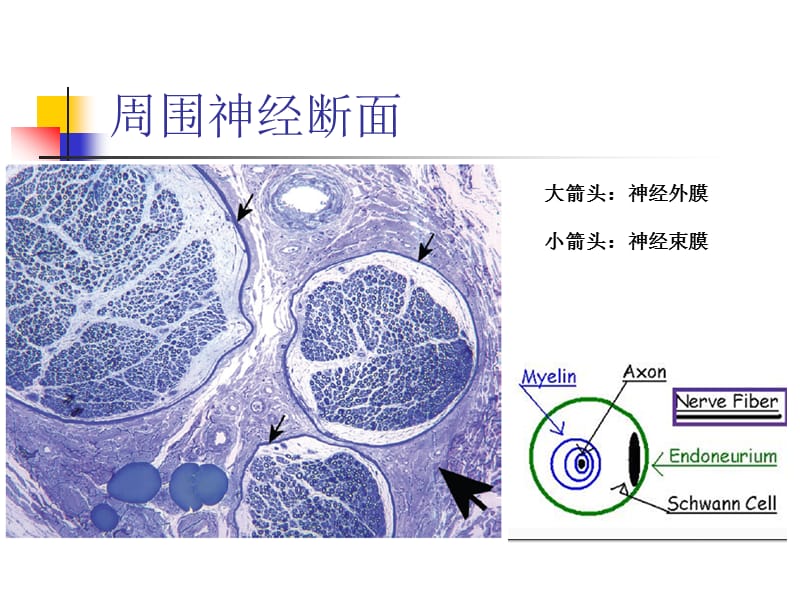 《肌电图基础》PPT课件.ppt_第3页