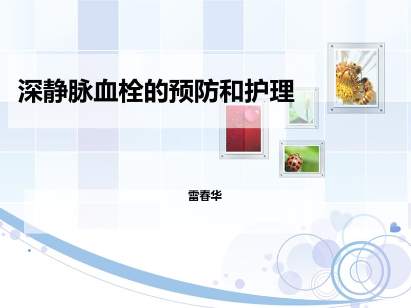 DVT形成预防和护理措施.ppt_第1页