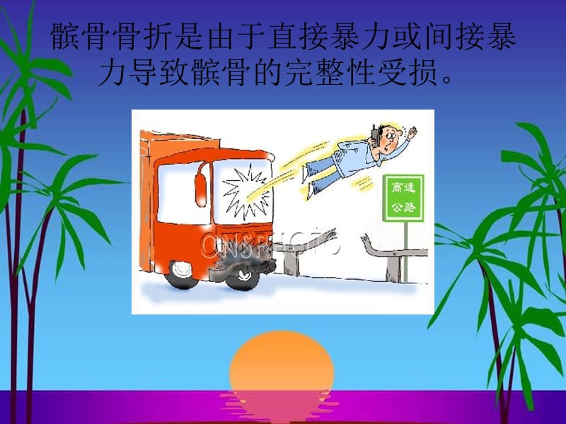 髌骨骨折的康复护理.ppt_第2页