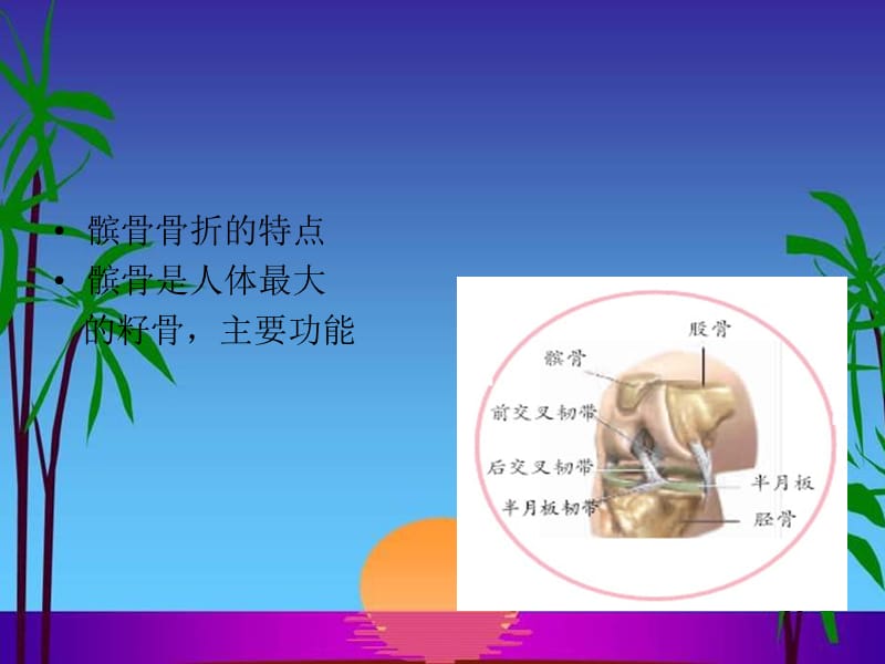 髌骨骨折的康复护理.ppt_第3页