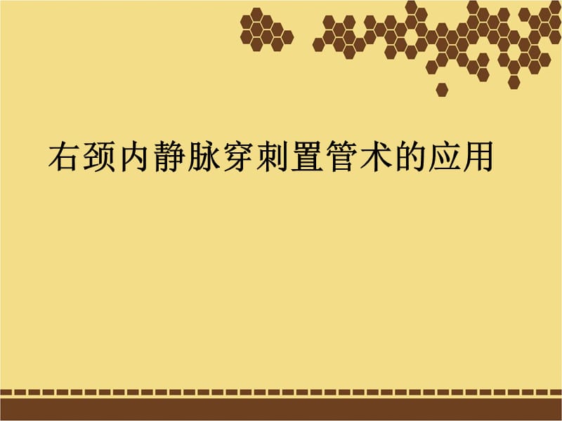 颈内静脉穿刺置管术.ppt_第1页