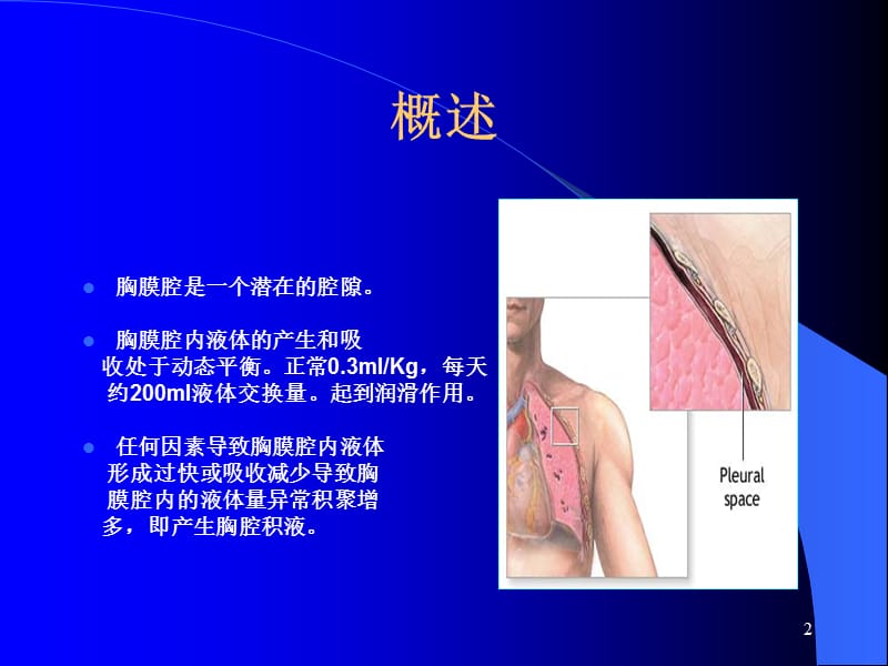 胸腔积液的诊断和鉴别诊断及结核性胸膜炎的治疗-科室讲座.ppt_第2页