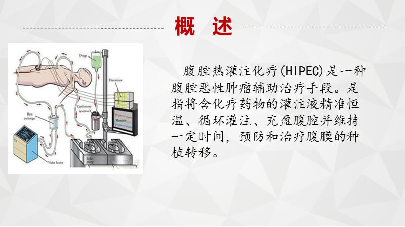 腹腔热灌注的作用原理.ppt_第3页