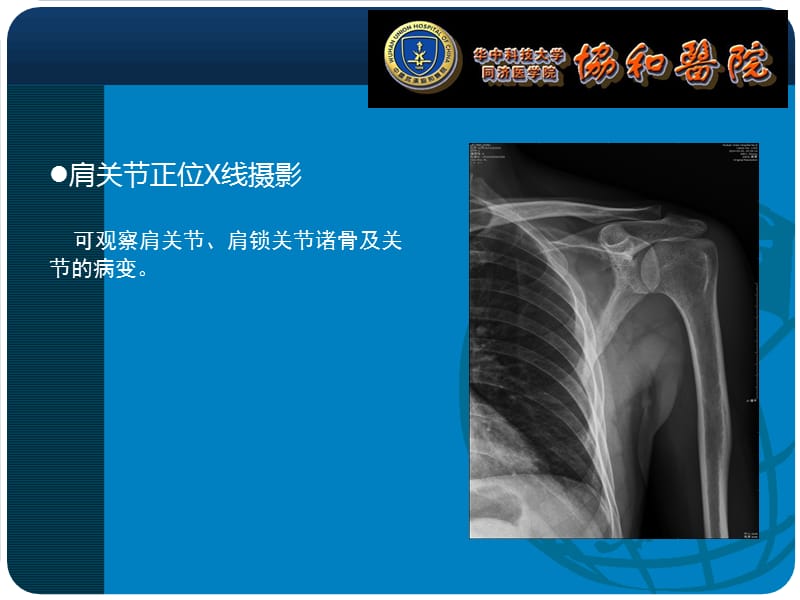 肩部X线摄影-课件.ppt_第3页