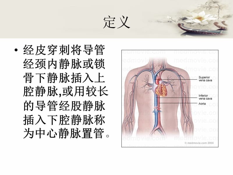 中心静脉置管维护及使用.ppt_第3页