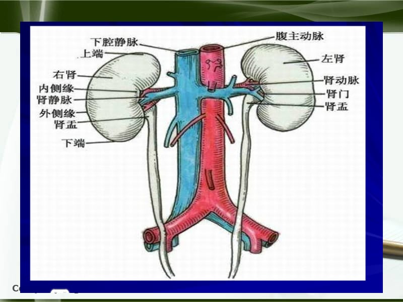 肾切除护理查房.ppt_第3页