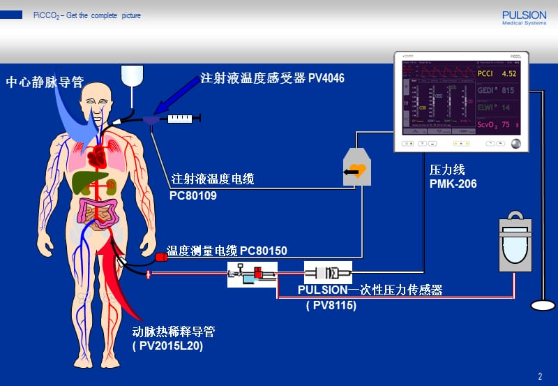 PiCCO参数解读-标准版.ppt_第2页