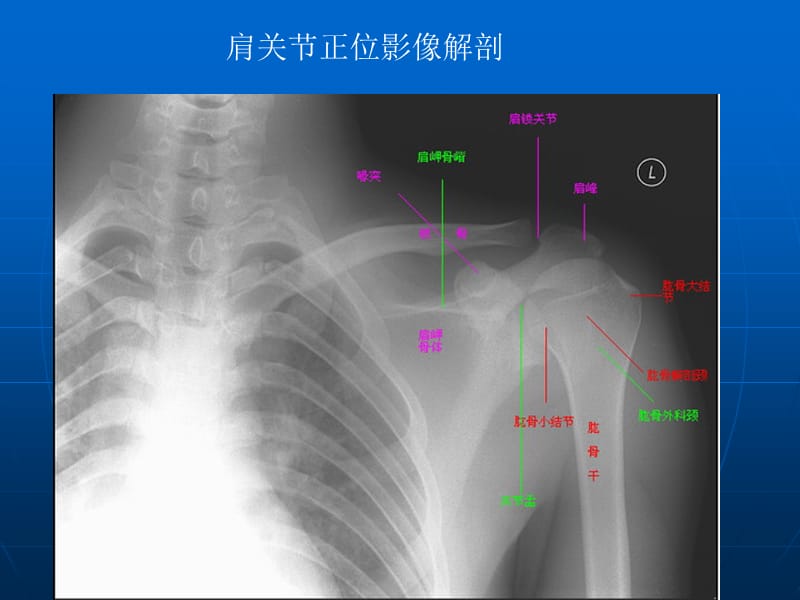 肩关节的摄影体位.ppt_第3页