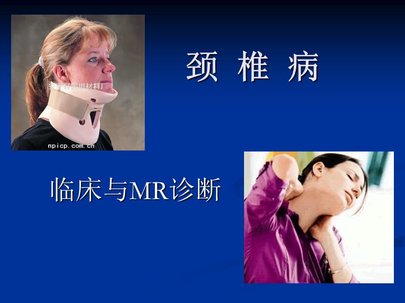 颈椎病的MRI诊断.ppt_第1页