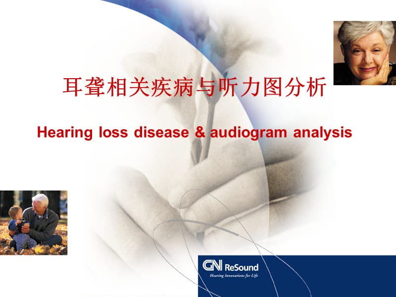 耳聋相关疾病与听力图分析.ppt_第1页
